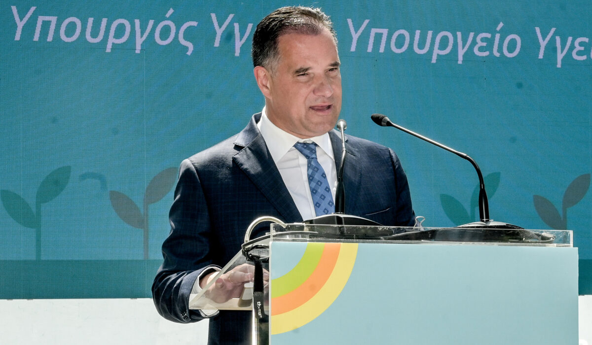 Ο Άδωνις παραδέχθηκε ότι έκανε μεταμόσχευση μαλλιών