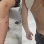 Βόλος: Αδέσποτα σκυλιά επιτέθηκαν σε 7χρονο – Τον δάγκωσαν σε όλο το σώμα