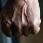 Αγριότητα στη Θεσσαλονίκη: Τον ξυλοκόπησαν, τον μαχαίρωσαν και έβαλαν τον σκύλο τους να τον δαγκώσει
