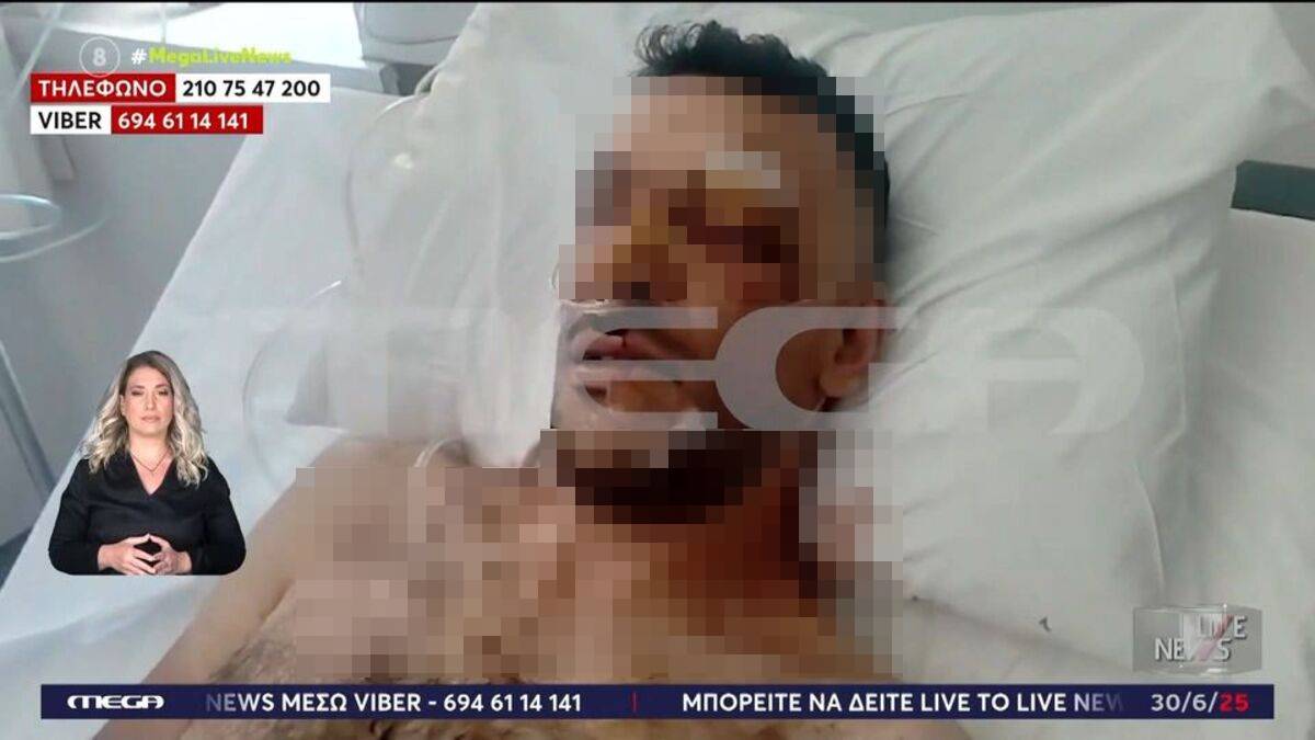 Μυτιλήνη: Σοκάρει ο αδερφός του 35χρονου που μαχαιρώθηκε 18 φορές – «Του αφαίρεσαν τη σπλήνα, έχει τρύπες στον πνεύμονα»