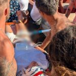 Παραλίγο τραγωδία στη Δονούσα: Ομπρέλα καρφώθηκε στο πόδι νεαρής - Σοκαριστικές εικόνες