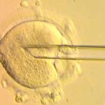 Βρετανία: Γεννήθηκαν οκτώ μωρά με DNA από τρεις ανθρώπους - Νίκη της επιστήμης έναντι ανίατης ασθένειας