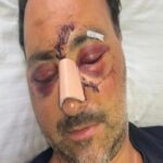 Κρήτη, Ξυλοδαρμός