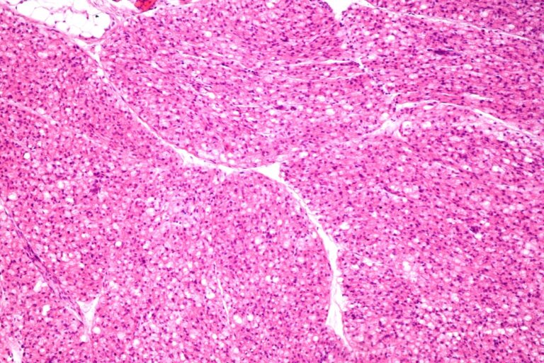 &kappa;&rho;ύ&omicron;