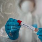 Ο θανατηφόρος ιός Nipah προκαλεί συναγερμό στην Ασία – Οι πιθανότητες για νέα πανδημία