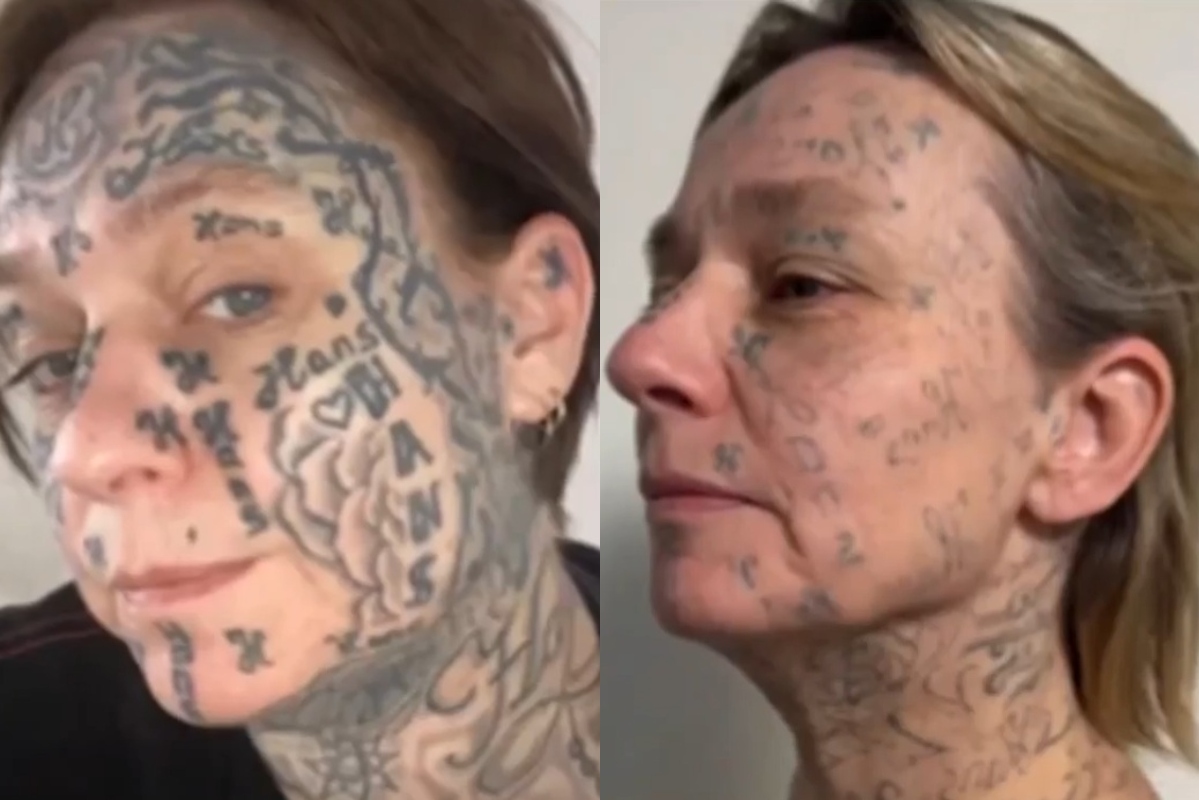 Ανατριχιαστική κακοποίηση γυναίκας στην Ολλανδία – Της έκανε εκατοντάδες τατουάζ για να δείξει ότι του «ανήκει»