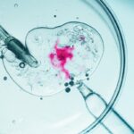 IVF